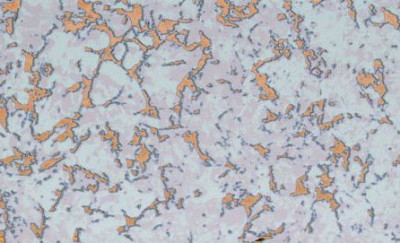 Раковина накладная Globo GENESIS 55.37